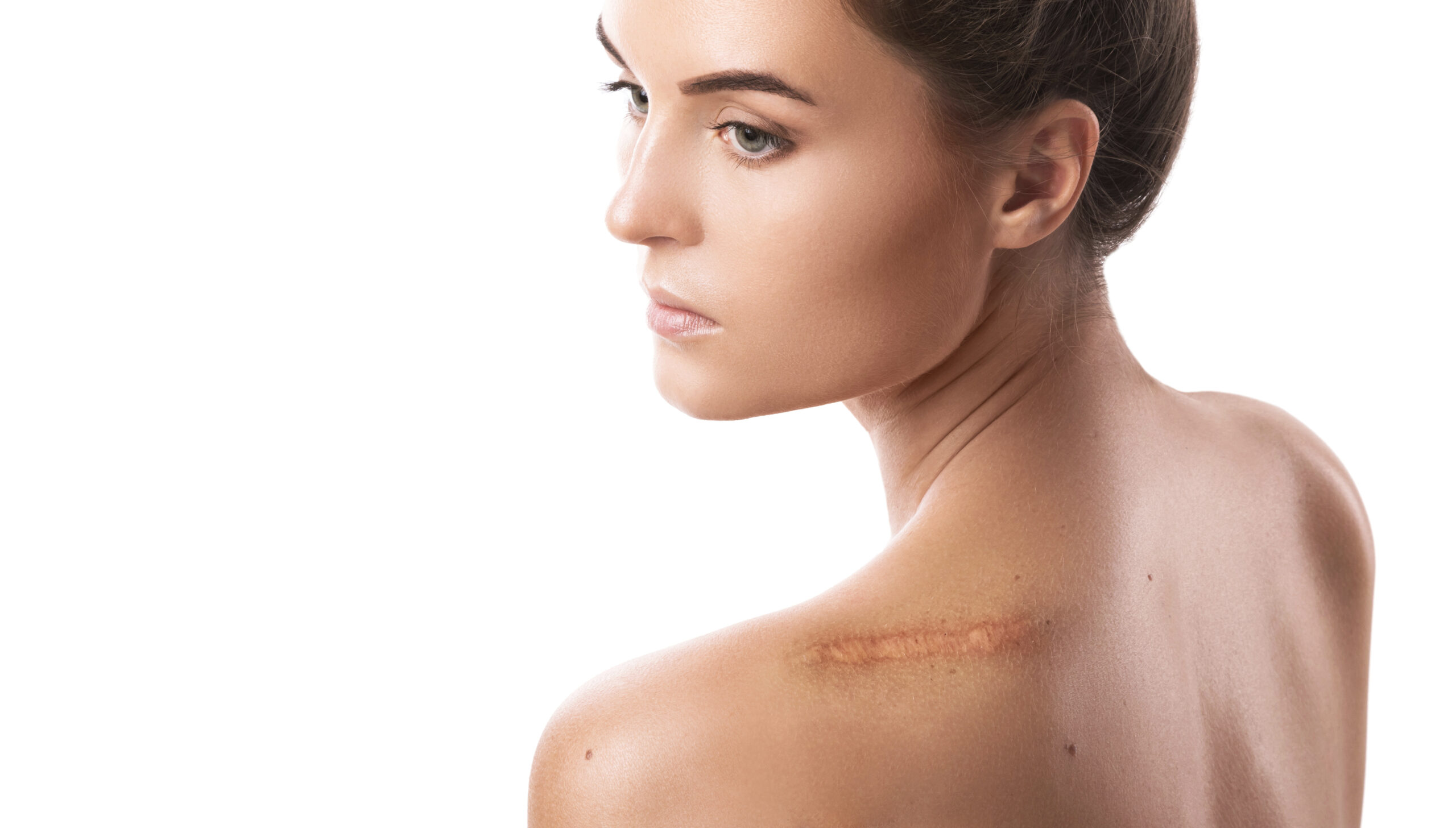 All About Scarring: What Can Help?